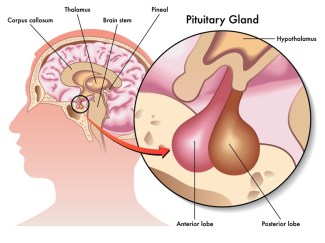 Pituitary3